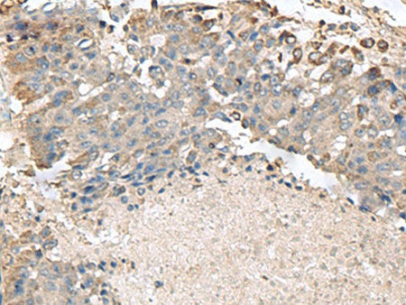 TMEM141 Polyclonal Antibody Reactivity Human