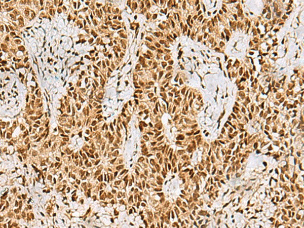 PHF5A Polyclonal Antibody Reactivity Human