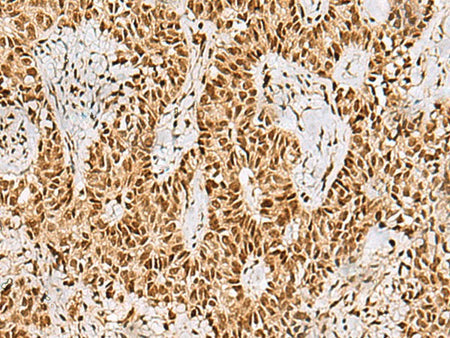 PHF5A Polyclonal Antibody Reactivity Human