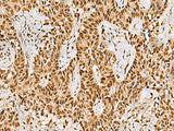 PHF5A Polyclonal Antibody Reactivity Human