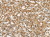 PHF5A Polyclonal Antibody Reactivity Human