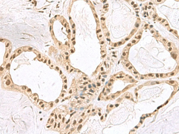 PCLAF Polyclonal Antibody Reactivity Human