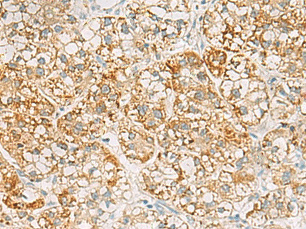 SH3YL1 Polyclonal Antibody