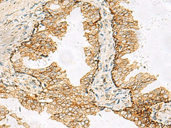 SH3YL1 Polyclonal Antibody