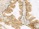 SH3YL1 Polyclonal Antibody