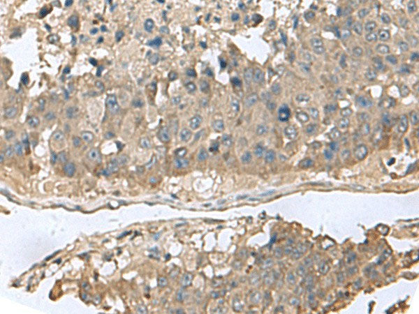 GABARAPL2 Polyclonal Antibody Reactivity Human