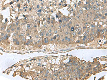 GABARAPL2 Polyclonal Antibody Reactivity Human