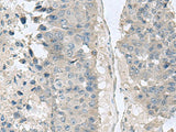 NPHP1 Polyclonal Antibody Reactivity Human