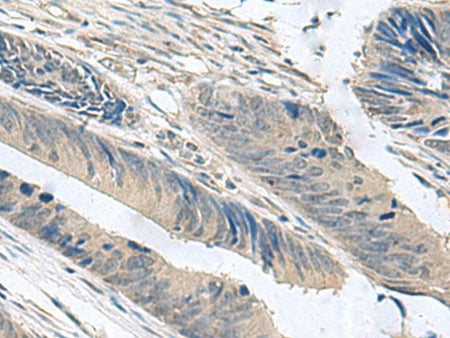 NPHP1 Polyclonal Antibody Reactivity Human