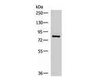 NPHP1 Polyclonal Antibody Reactivity Human