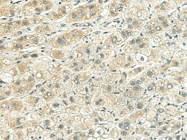 RHBDL2 Polyclonal Antibody Reactivity Human
