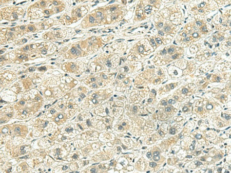 RHBDL2 Polyclonal Antibody Reactivity Human