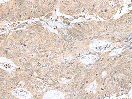 RPL35 Polyclonal Antibody Reactivity Human