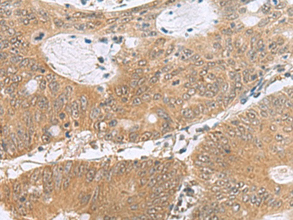 PHPT1 Polyclonal Antibody Reactivity Human