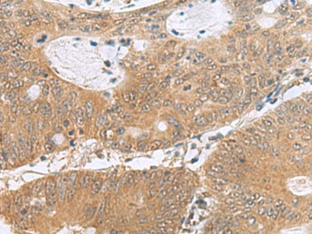 PHPT1 Polyclonal Antibody Reactivity Human