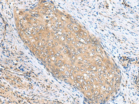 PHPT1 Polyclonal Antibody Reactivity Human
