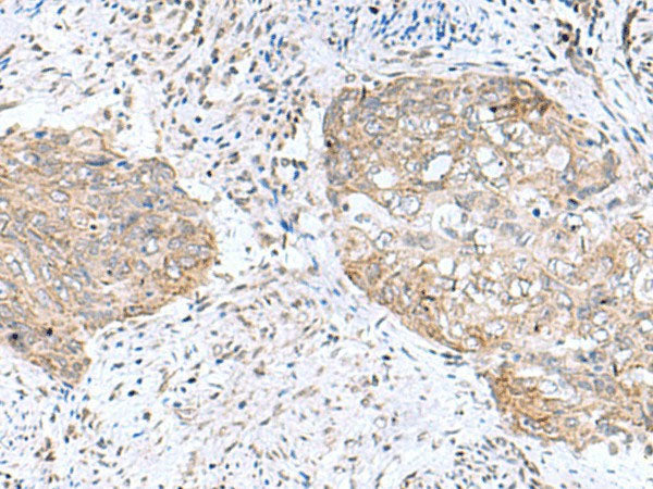 PAM16 Polyclonal Antibody Reactivity Human