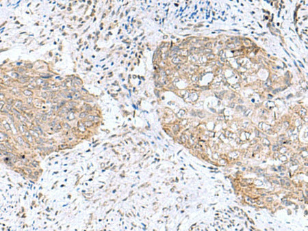 PAM16 Polyclonal Antibody Reactivity Human