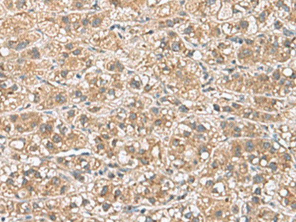 PHLDA3 Polyclonal Antibody Reactivity Human