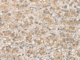PHLDA3 Polyclonal Antibody Reactivity Human