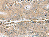 PTPRS Polyclonal Antibody Reactivity Human
