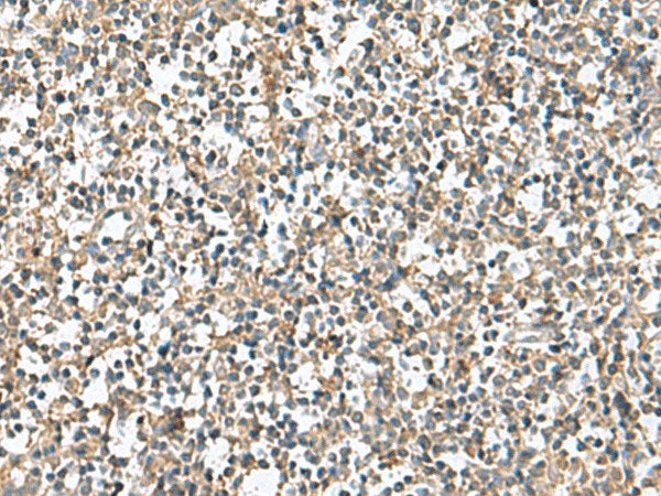 PTPRS Polyclonal Antibody Reactivity Human