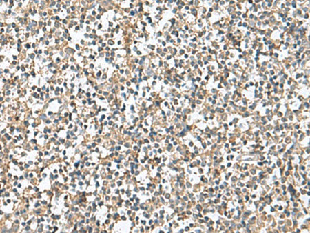 PTPRS Polyclonal Antibody Reactivity Human