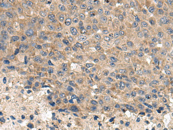 CD59 Polyclonal Antibody Reactivity Human
