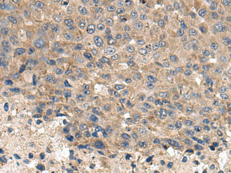 CD59 Polyclonal Antibody Reactivity Human