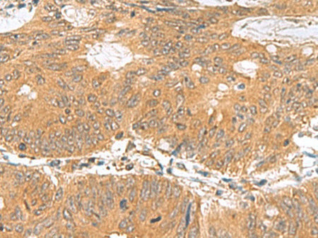 GEMIN7 Polyclonal Antibody Reactivity Human