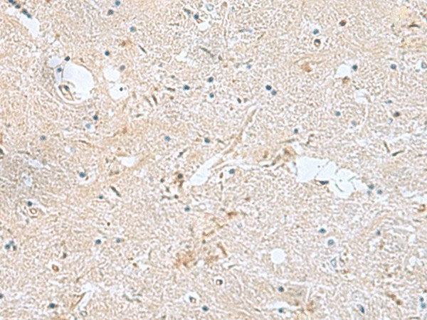FAM107B Polyclonal Antibody Reactivity Human
