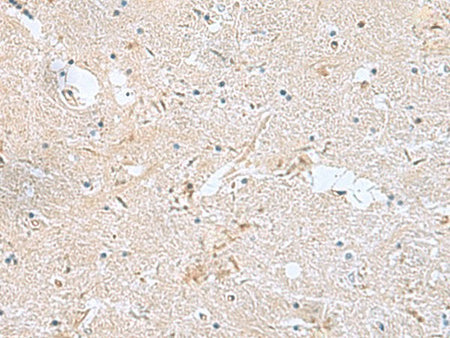 FAM107B Polyclonal Antibody Reactivity Human
