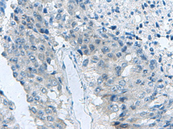 MED31 Polyclonal Antibody Reactivity Human