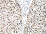 MIA Polyclonal Antibody Reactivity Human