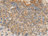 MIA Polyclonal Antibody Reactivity Human