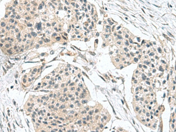 TPD52L3 Polyclonal Antibody Reactivity Human