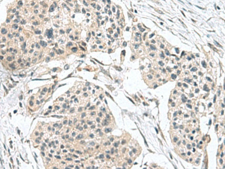 TPD52L3 Polyclonal Antibody Reactivity Human