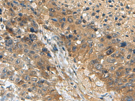 TPD52L3 Polyclonal Antibody Reactivity Human