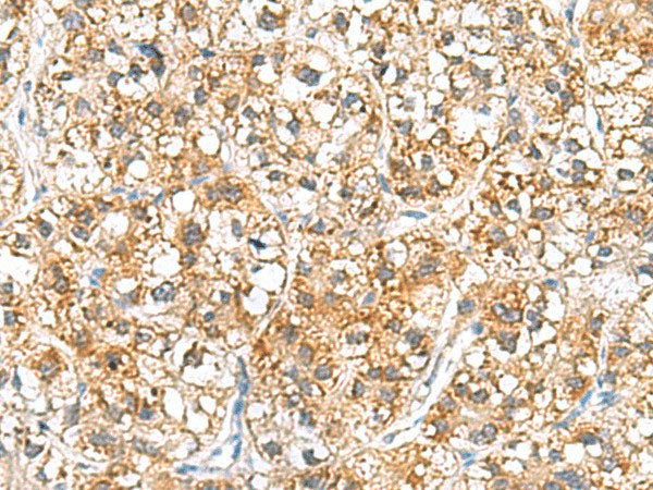 RIDA Polyclonal Antibody Reactivity Human