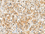 RIDA Polyclonal Antibody Reactivity Human