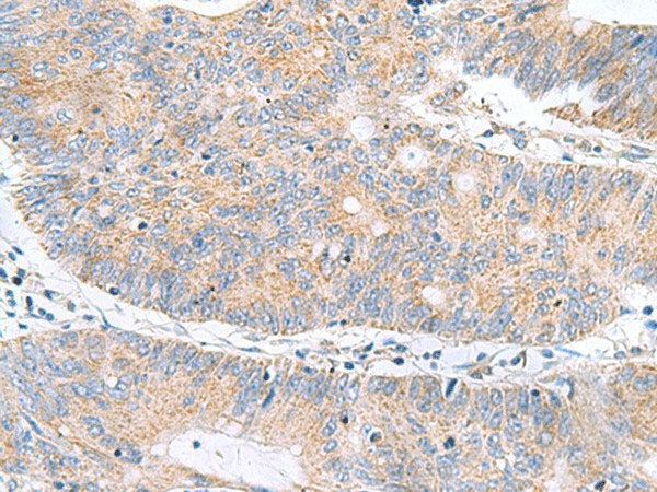 RIDA Polyclonal Antibody Reactivity Human