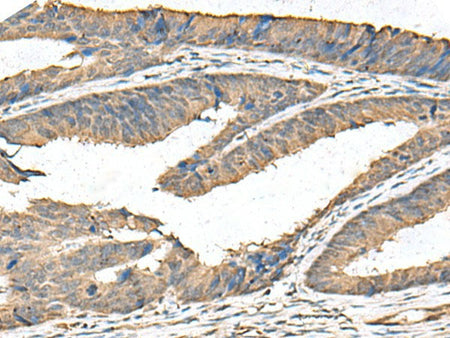 FAM19A4 Polyclonal Antibody Reactivity Human