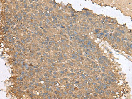 FAM19A4 Polyclonal Antibody Reactivity Human