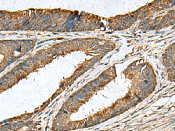 MRPL42 Polyclonal Antibody Reactivity Human