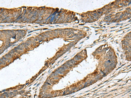 MRPL42 Polyclonal Antibody Reactivity Human