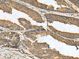 EIF1AX Polyclonal Antibody Reactivity Human