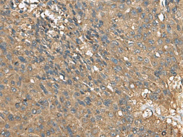 EIF1AX Polyclonal Antibody Reactivity Human