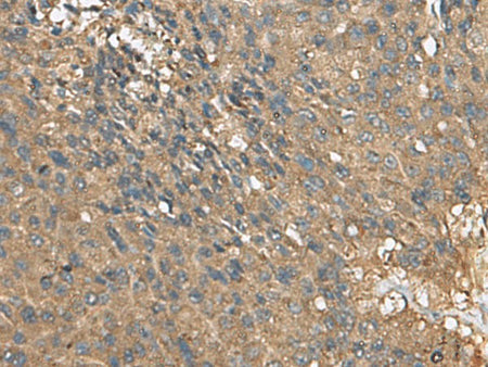 EIF1AX Polyclonal Antibody Reactivity Human