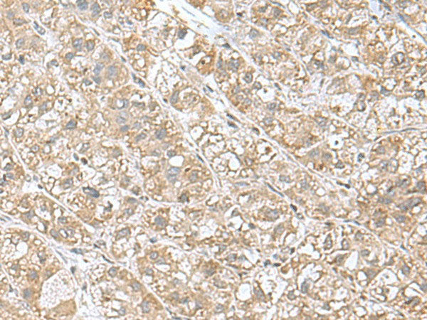 EIF1AY Polyclonal Antibody