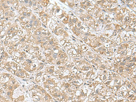 EIF1AY Polyclonal Antibody